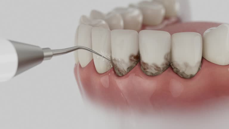 Reliable Emergency Dentist contractor in Spring Hope, NC by Smile Center Dentistry